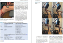 Angewandte Sportphysiotherapie - Untere Extremität
